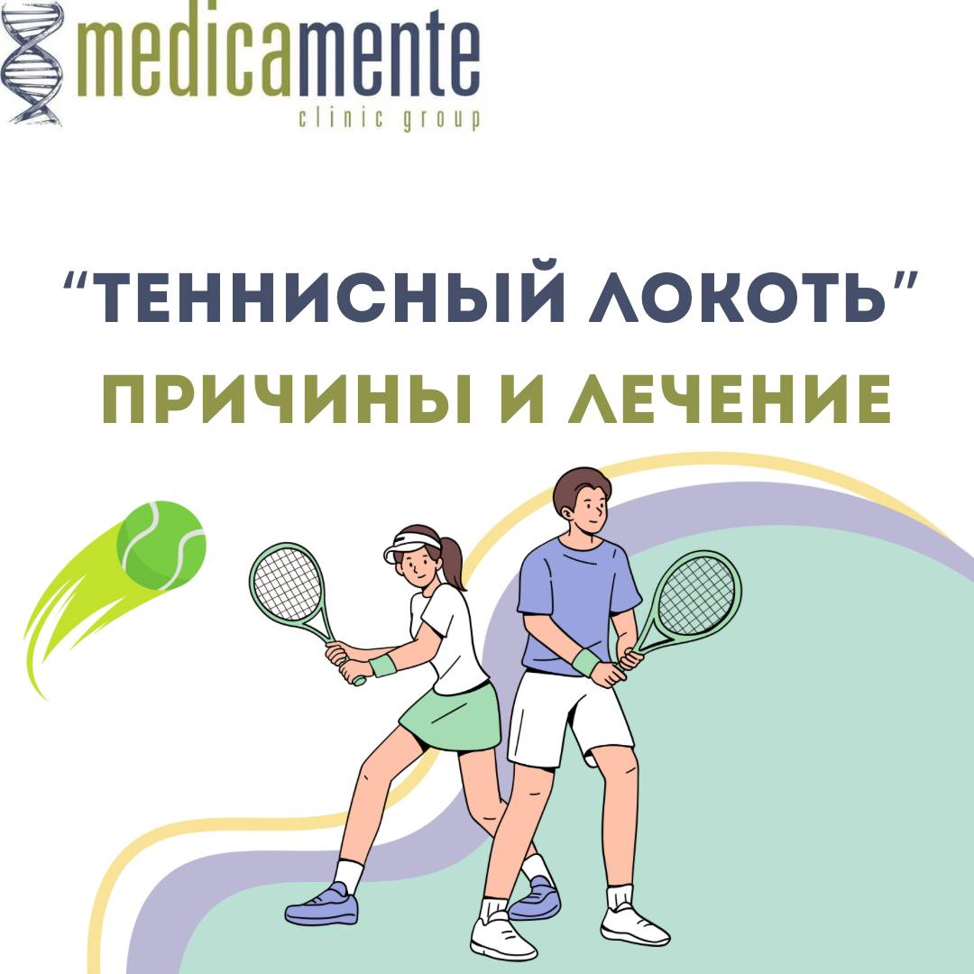 Латеральный эпикондилит локтевого сустава